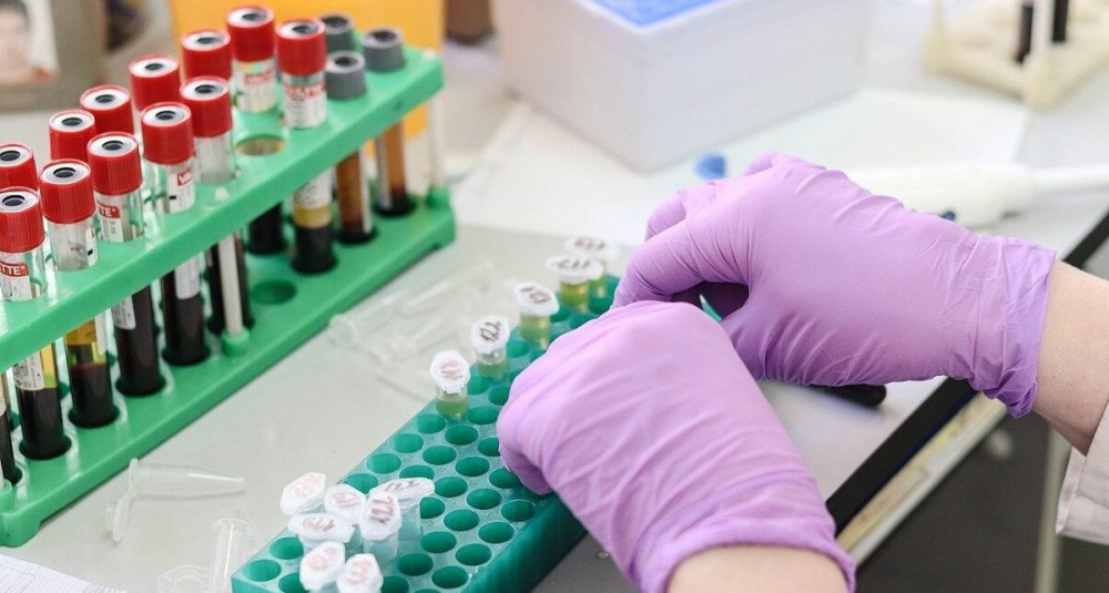ΕΚΠΑ: μπορεί μία εξέταση αίματος να διαγνώσει έγκαιρα διάφορες μορφές καρκίνου;