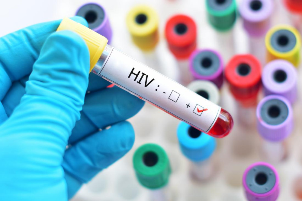 “Φρένο” στις διακρίσεις ασθενών από HIV βάζει η κυβέρνηση