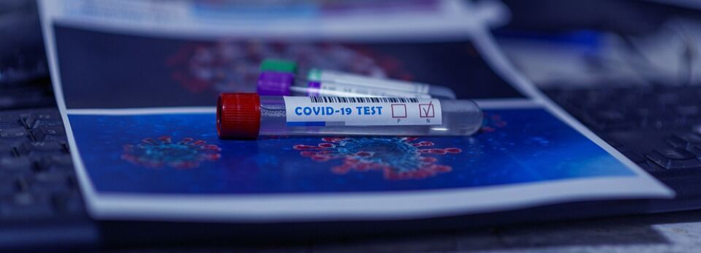 ΕΟΔΥ: Δωρεάν rapid tests σε 156 σημεία την Παρασκευή 25/11