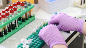 ΕΚΠΑ: μπορεί μία εξέταση αίματος να διαγνώσει έγκαιρα διάφορες μορφές καρκίνου;