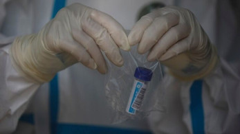 Πώς ξεκίνησε η πανδημία;-Τρεις ερευνητές στην Ουχάν είχαν συμπτώματα από το 2019