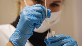Κορωνοϊός: 17.662 νέα κρούσματα, 106 θάνατοι, 568 διασωληνωμένοι