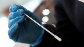 ΕΟΔΥ: Τα 179 σημεία δωρεάν rapid test κορωνοϊού την Παρασκευή
