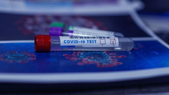 Covid -19: τα rapid tests του ΕΟΔΥ το Σάββατο 13/5