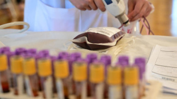 Εθελοντική αιμοδοσία: «Τις γιορτές κάποιοι περιμένουν ένα δώρο, άλλοι… περιμένουν εσένα» (video)